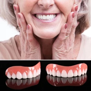 Instant Smile Teeth Veneer (Upper & Lower)