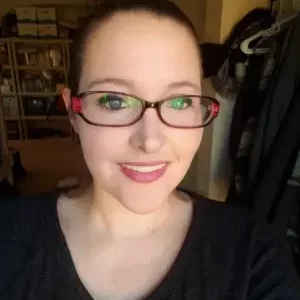 Instant Smile Veneer (Upper Only) photo review