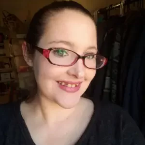 Instant Smile Veneer (Upper Only) photo review