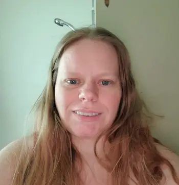 Instant Smile Snap On Veneers (Upper & Lower) Smile Teeth Veneers photo review