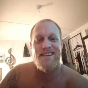 Instant Smile Veneer (Upper Only) photo review