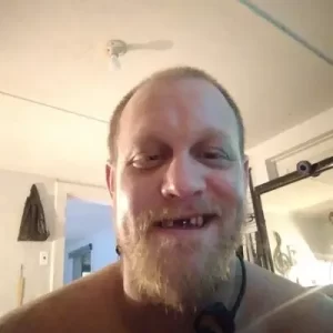 Instant Smile Veneer (Upper Only) photo review