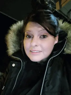 Instant Smile Veneer (Upper Only) photo review