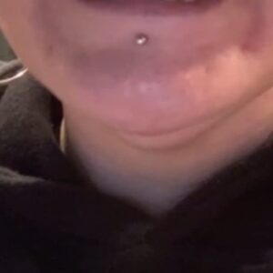 Instant Smile Veneer (Upper Only) photo review