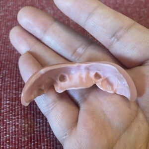 Instant Smile Veneer (Upper Only) photo review