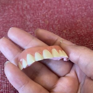 Instant Smile Veneer (Upper Only) photo review