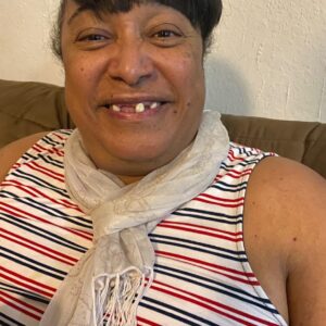 Instant Smile Veneer (Upper Only) photo review