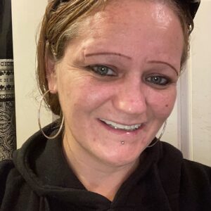 Instant Smile Veneer (Upper Only) photo review