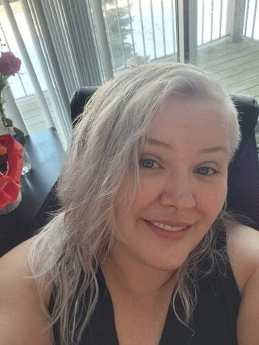 Instant Smile Veneer (Upper Only) photo review