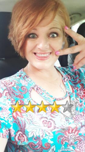 Instant Smile Veneer (Upper Only) photo review