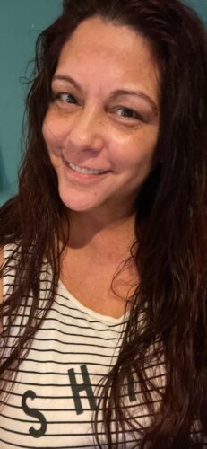 Instant Smile Veneer (Upper Only) photo review