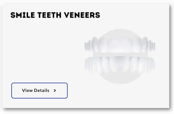 Snap On Smile veneers by InstantSmile